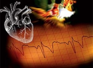 Неотложные состояния в кардиологии: лечение