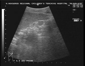 Эхографическая синдромология