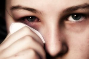 Аллергический конъюнктивит: лечение, симптомы, причины, признаки
