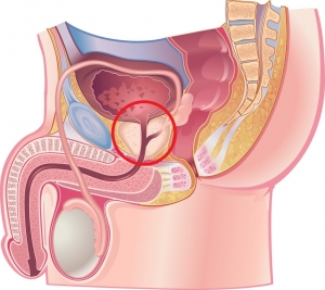Простата у мужчин: что это такое, строение, функции