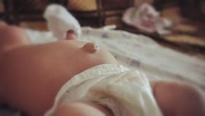 Пупочная грыжа у новорожденных детей: что это такое, лечение, симптомы, причины, признаки