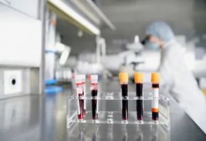 Гемофильтрация крови у детей: что это такое, показания, осложнения Гемофильтрация крови у детей: что это такое, показания, осложнения