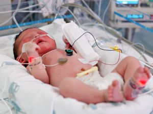 Шок у новорожденных детей: неотложная помощь, лечение, симптомы, признаки,причины