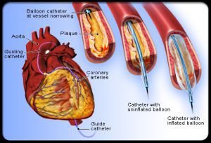 Исследование артерий
